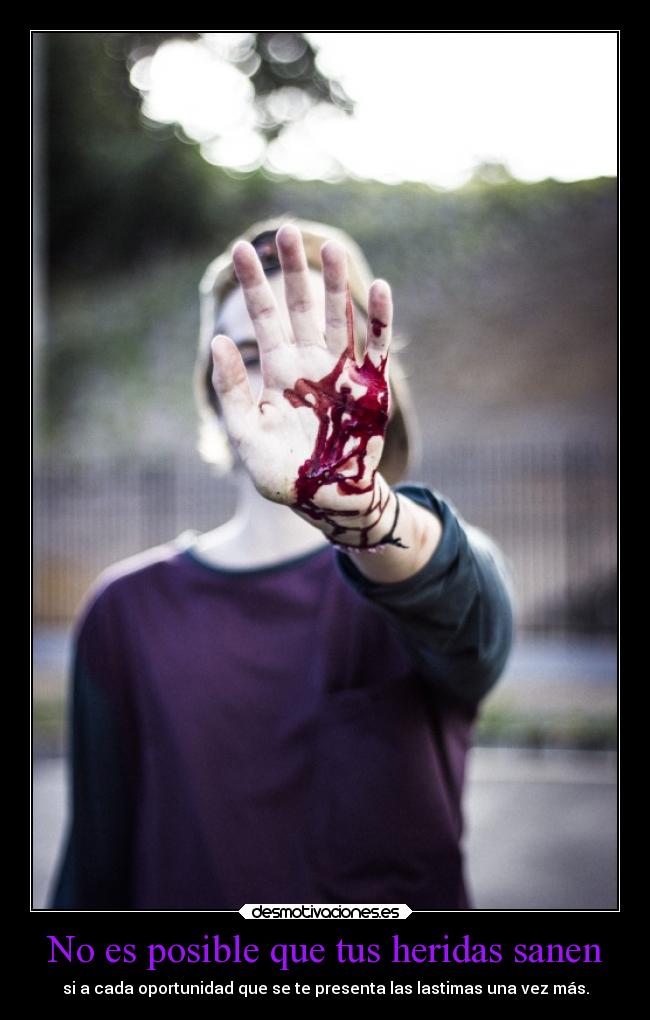 No es posible que tus heridas sanen - si a cada oportunidad que se te presenta las lastimas una vez más.