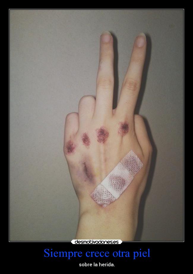 Siempre crece otra piel - 