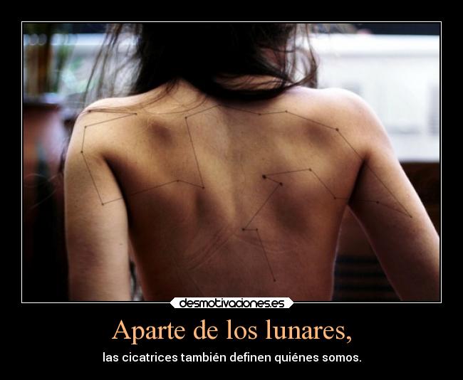 Aparte de los lunares, - las cicatrices también definen quiénes somos.