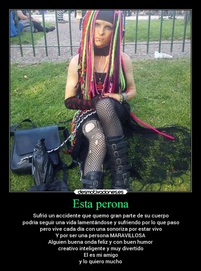 Esta perona - Sufrió un accidente que quemo gran parte de su cuerpo
podría seguir una vida lamentándose y sufriendo por lo que paso
pero vive cada día con una sonoriza por estar vivo
Y por ser una persona MARAVILLOSA
Alguien buena onda feliz y con buen humor
creativo inteligente y muy divertido
El es mi amigo
y lo quiero mucho