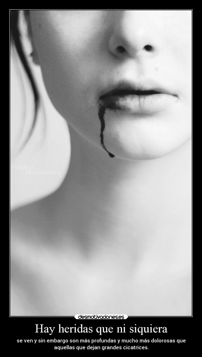 Hay heridas que ni siquiera -