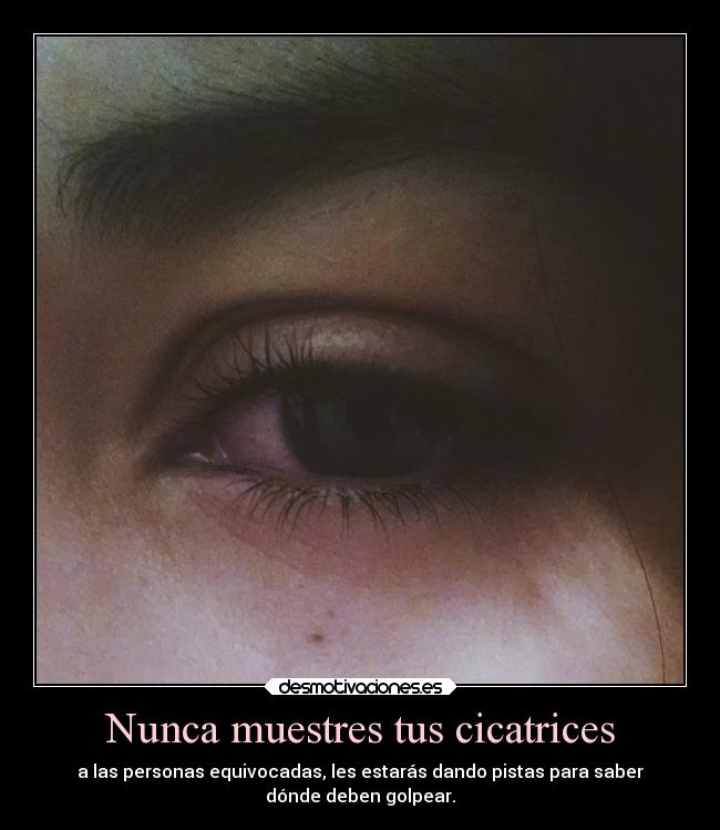 Nunca muestres tus cicatrices - 