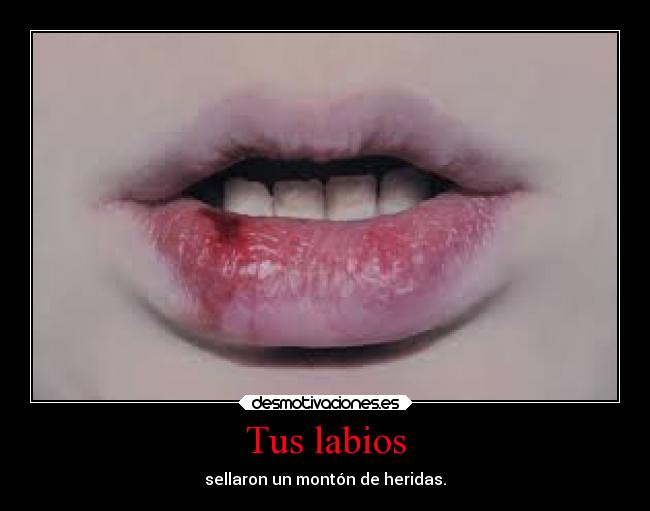 carteles dolor labios desmotivaciones