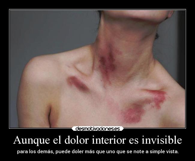 Aunque el dolor interior es invisible - para los demás, puede doler más que uno que se note a simple vista.