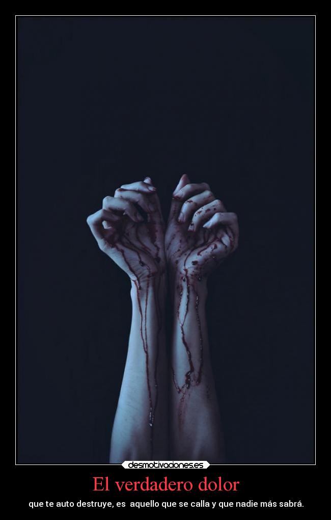 El verdadero dolor - 