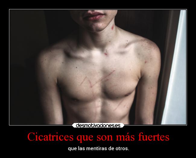 Cicatrices que son más fuertes -
