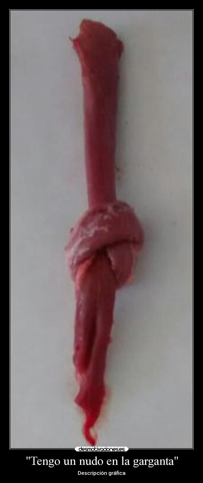 Tengo un nudo en la garganta - Descripción gráfica