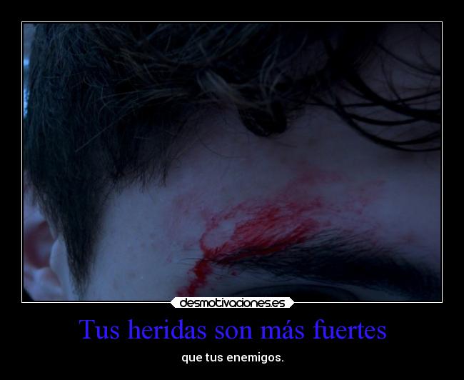 Tus heridas son más fuertes - 