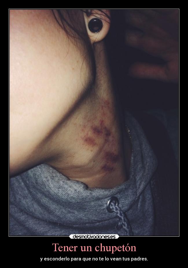 Tener un chupetón -