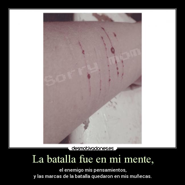 La batalla fue en mi mente, - el enemigo mis pensamientos,
y las marcas de la batalla quedaron en mis muñecas.