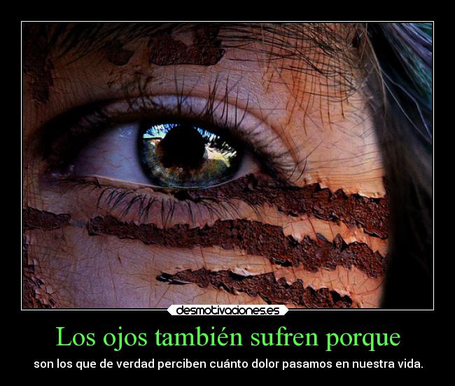 Los ojos también sufren porque -