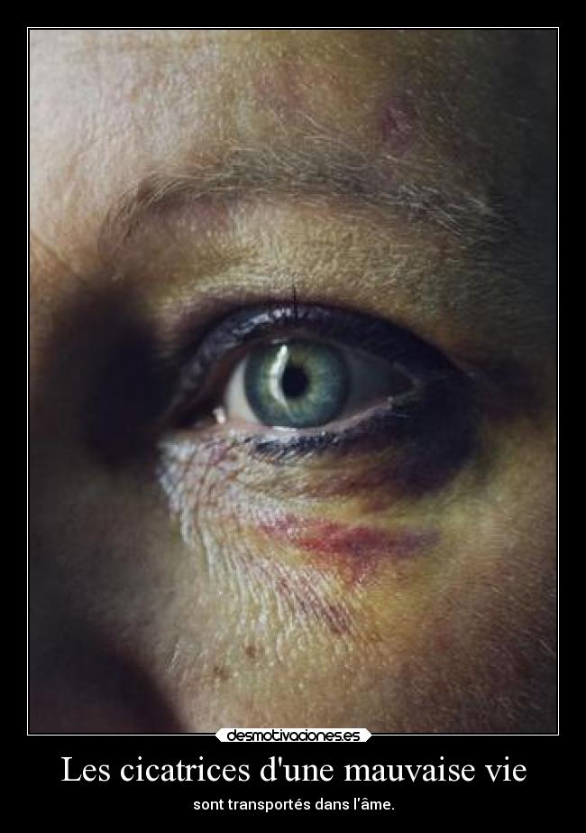 Les cicatrices dune mauvaise vie - sont transportés dans lâme.