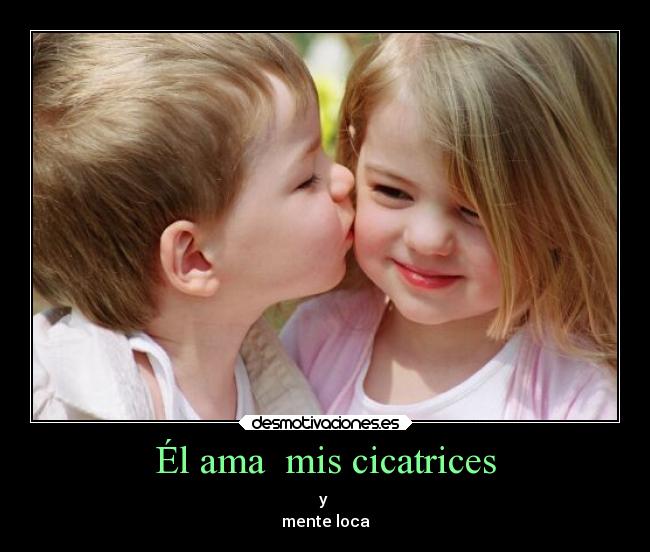 Él ama mis cicatrices - y
mente loca