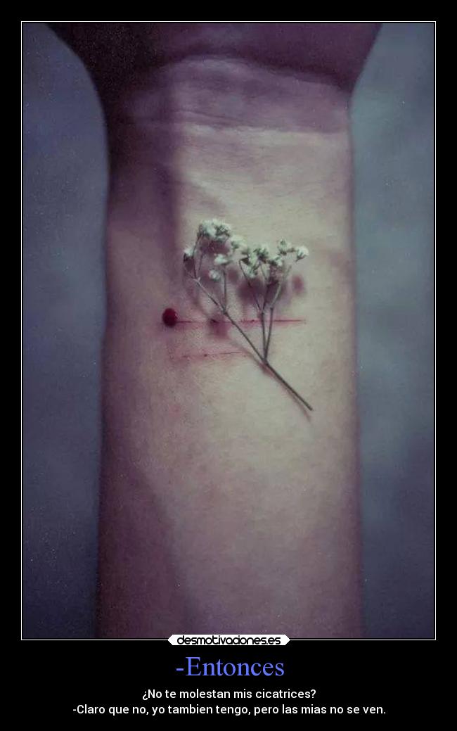 -Entonces - ¿No te molestan mis cicatrices?
-Claro que no, yo tambien tengo, pero las mias no se ven.