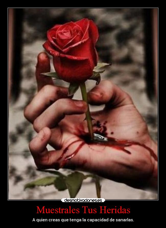 Muestrales Tus Heridas - A quien creas que tenga la capacidad de sanarlas.