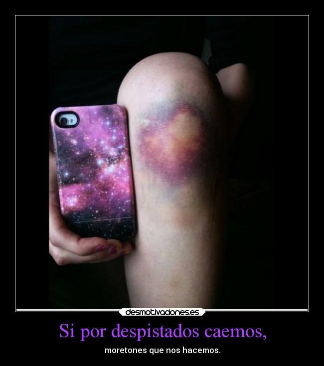 Si por despistados caemos, - moretones que nos hacemos.