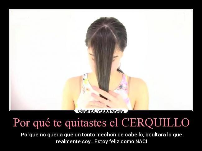 Por qué te quitastes el CERQUILLO - Porque no quería que un tonto mechón de cabello, ocultara lo que
realmente soy...Estoy feliz como NACI