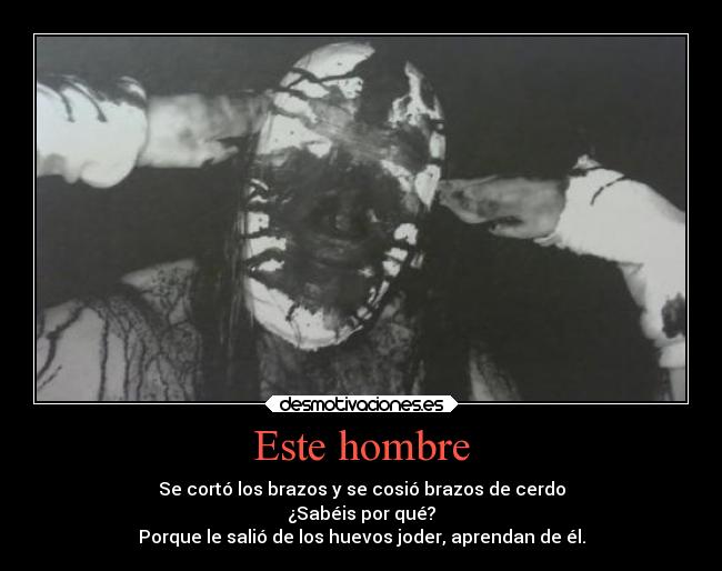 Este hombre - Se cortó los brazos y se cosió brazos de cerdo
¿Sabéis por qué?
Porque le salió de los huevos joder, aprendan de él.