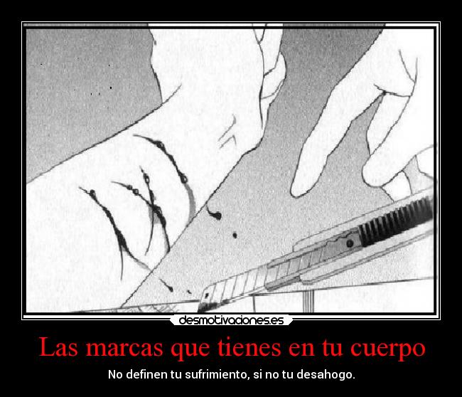 Las marcas que tienes en tu cuerpo - 