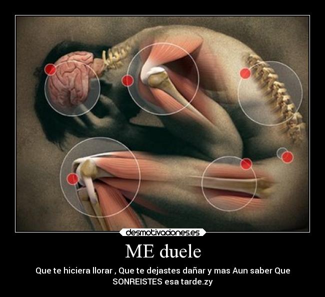 ME duele -