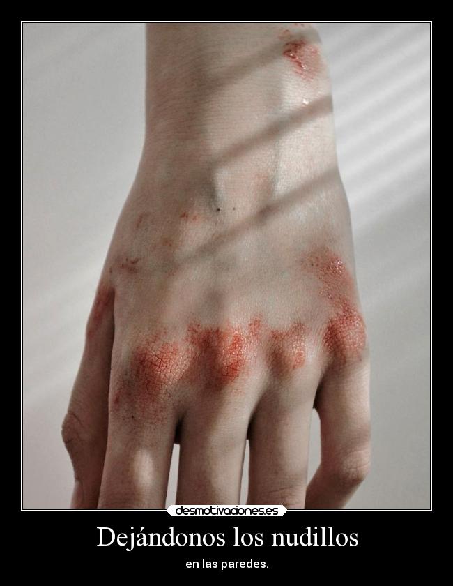 Dejándonos los nudillos -