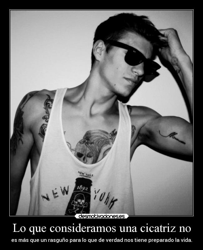 Lo que consideramos una cicatriz no - es más que un rasguño para lo que de verdad nos tiene preparado la vida.