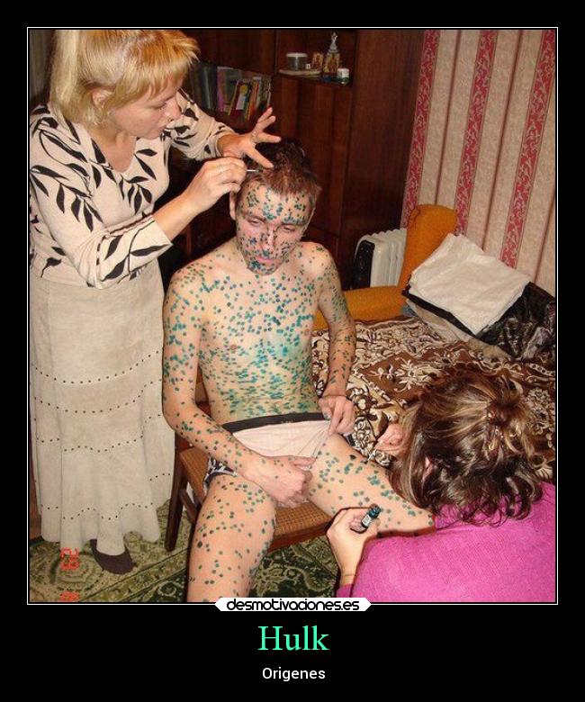 Hulk - Origenes