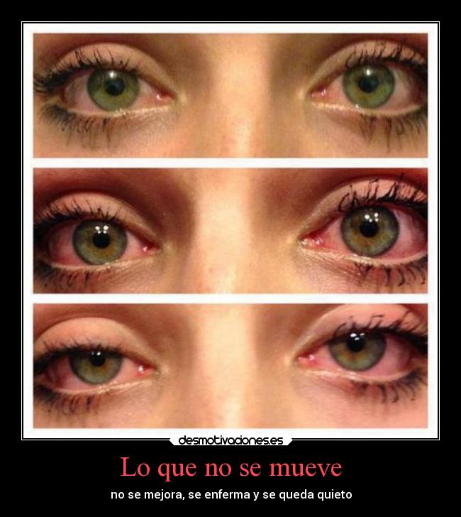 Lo que no se mueve - no se mejora, se enferma y se queda quieto