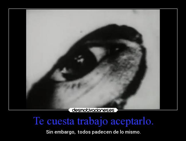 Te cuesta trabajo aceptarlo. - Sin embargo, todos padecen de lo mismo.