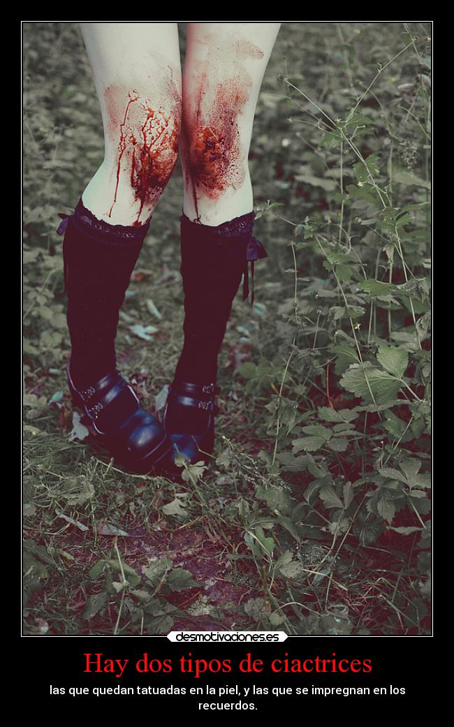 Hay dos tipos de ciactrices - las que quedan tatuadas en la piel, y las que se impregnan en los
recuerdos.