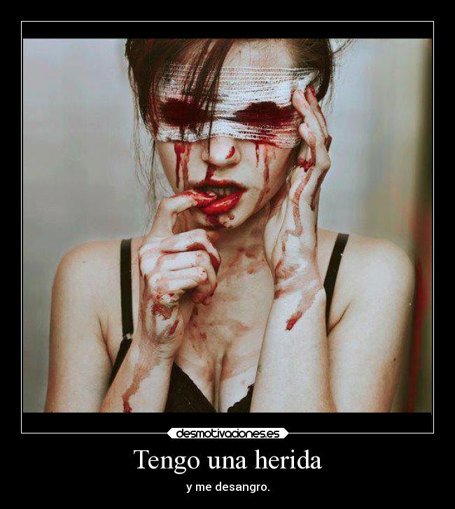 Tengo una herida - y me desangro.