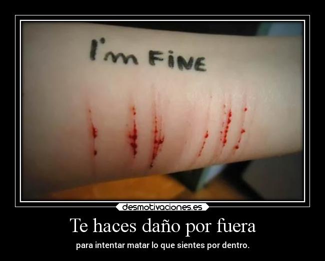 Te haces daño por fuera -