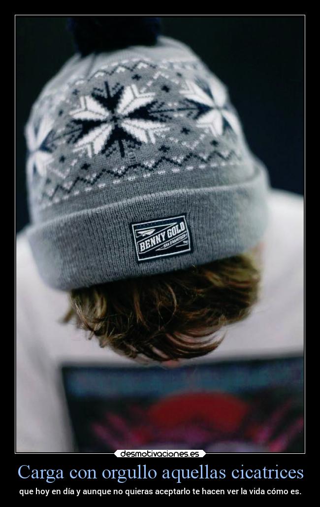 Carga con orgullo aquellas cicatrices - que hoy en día y aunque no quieras aceptarlo te hacen ver la vida cómo es.
