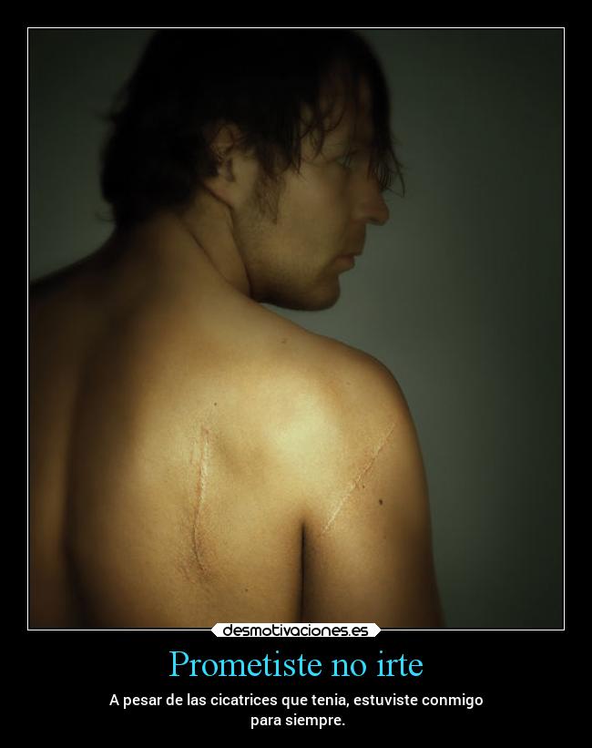 Prometiste no irte - A pesar de las cicatrices que tenia, estuviste conmigo
para siempre.