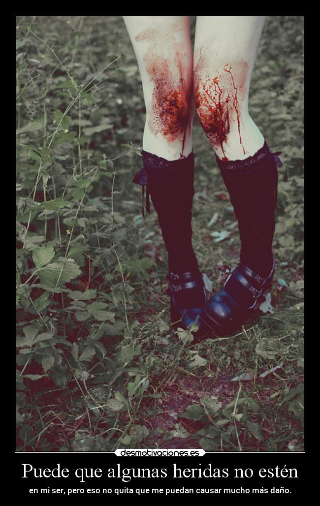 Puede que algunas heridas no estén - en mi ser, pero eso no quita que me puedan causar mucho más daño.