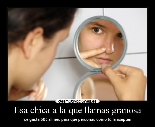 Esa chica a la que llamas granosa - se gasta 50€ al mes para que personas como tú la acepten