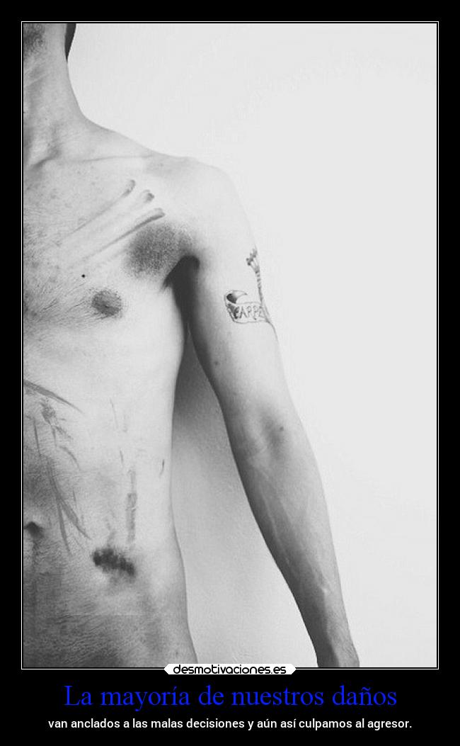 La mayoría de nuestros daños -