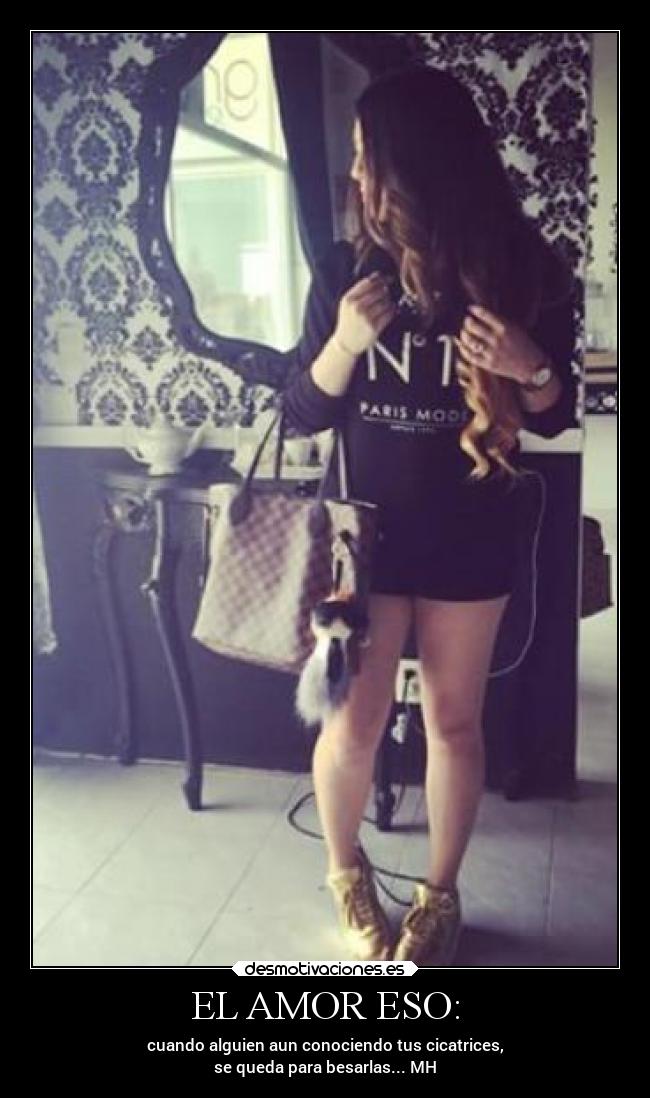EL AMOR ESO: -