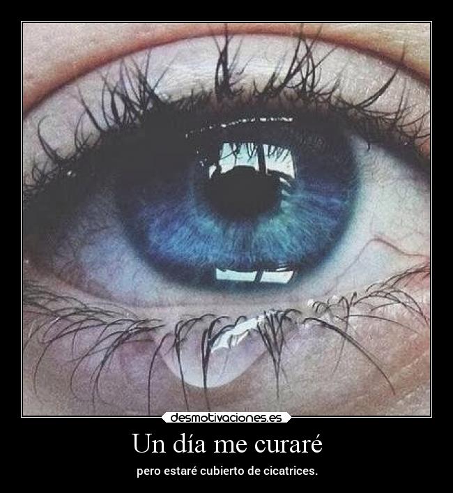 Un día me curaré - pero estaré cubierto de cicatrices.