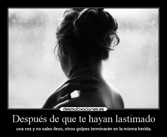 Después de que te hayan lastimado -