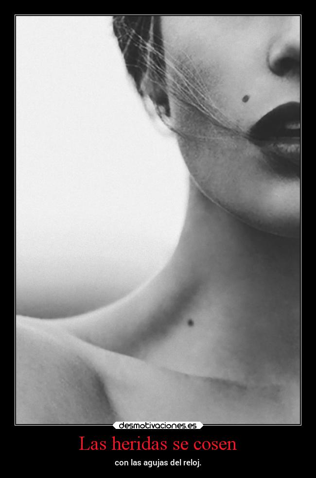 Las heridas se cosen - 