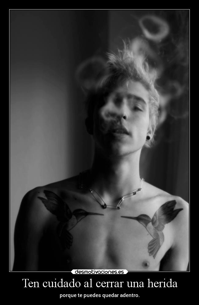 Ten cuidado al cerrar una herida - 