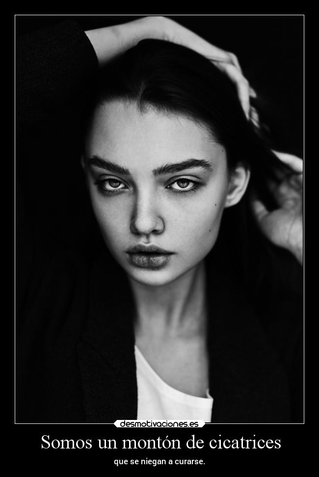 Somos un montón de cicatrices - que se niegan a curarse.