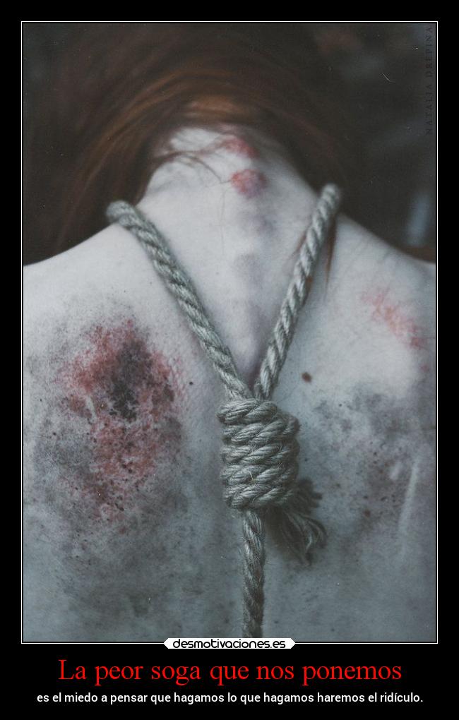 La peor soga que nos ponemos - 