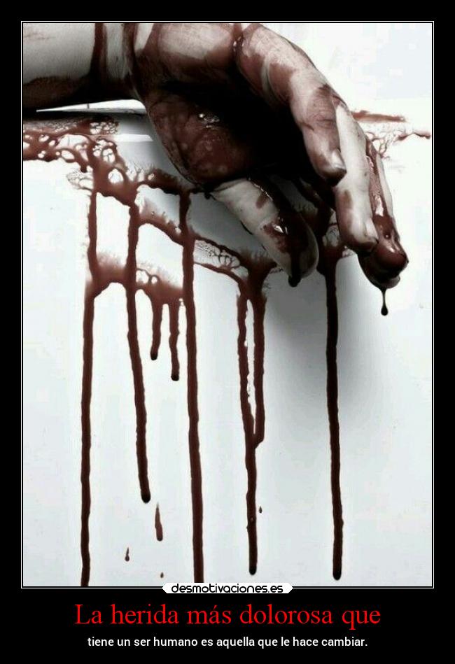 La herida más dolorosa que - 