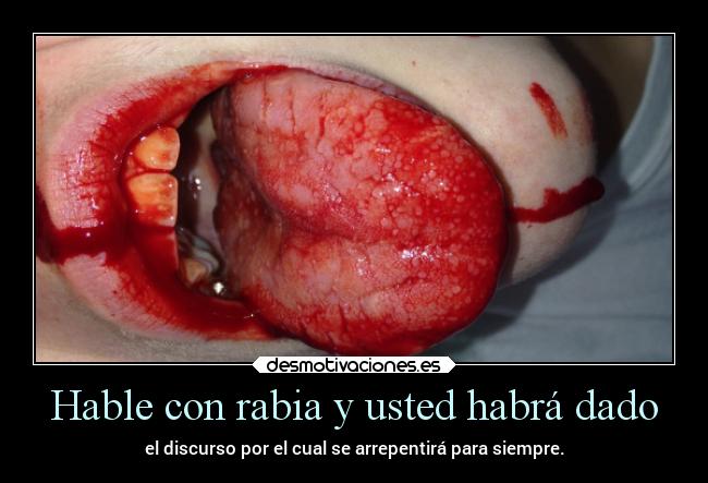 Hable con rabia y usted habrá dado - el discurso por el cual se arrepentirá para siempre.