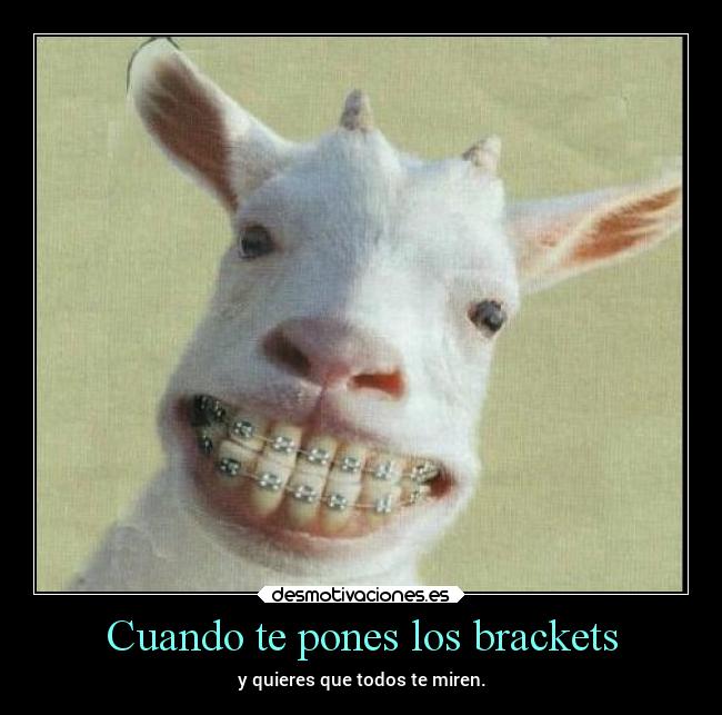 Cuando te pones los brackets - 