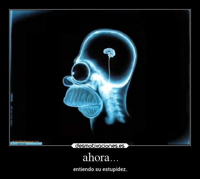 ahora... - entiendo su estupidez.