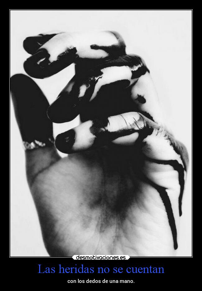 carteles dolor vida manos heridas mels sufrimiento dedos desmotivaciones