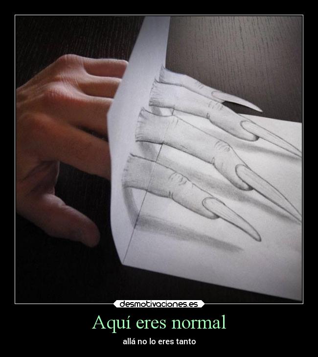 Aquí eres normal - 